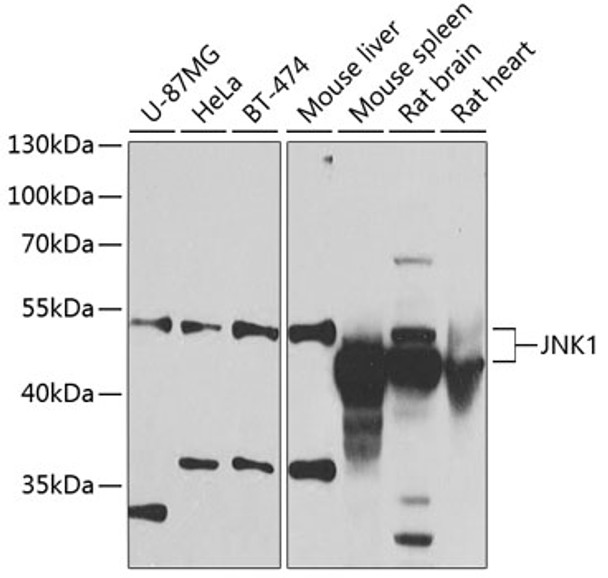 Western blot analysis of extracts of various cell lines, using JNK1 antibody (CAB2462) at 1:1000 dilution. Secondary antibody: HRP Goat Anti-Rabbit IgG (H+L) at 1:10000 dilution. Lysates/proteins: 25μg per lane. Blocking buffer: 3% nonfat dry milk in TBST.