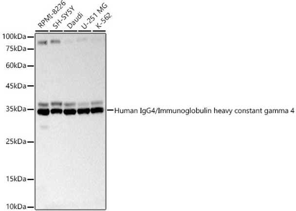 Western blot analysis of various lysates, using Human IgG4/Immunoglobulin heavy constant gamma 4 Rabbit pAb (CAB24655) at 1:1000 dilution. Secondary antibody: HRP Goat Anti-Rabbit IgG (H+L) at 1:10000 dilution. Lysates/proteins: 25ug per lane. Blocking buffer: 3% nonfat dry milk in TBST.