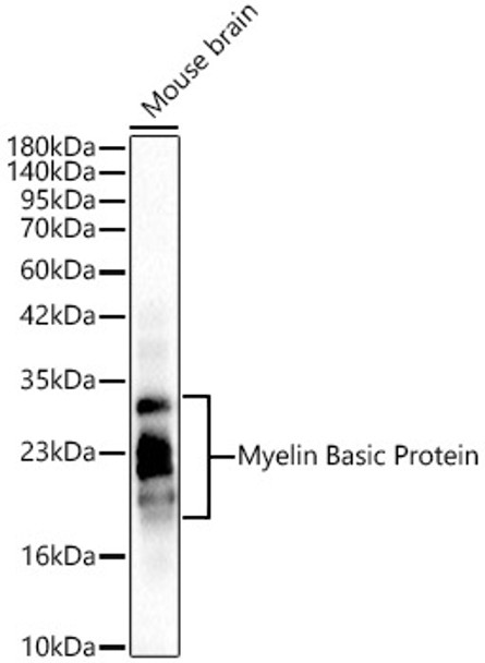 Western blot analysis of lysates from Mouse brain using Myelin Basic Protein/MBP Rabbit pAb(CAB24860) at 1:800 dilution. Secondary antibody:HRP Goat Anti-Rabbit IgG (H+L) at 1:10000 dilution. Lysates/proteins: 25 μg per lane. Blocking buffer: 3% nonfat dry milk in TBST. Detection:ECL Basic Kit (RM00020). Exposuretime:0. 5s.