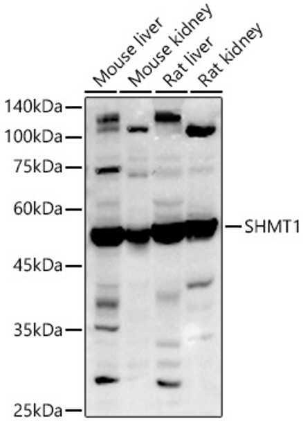 Western blot analysis of extracts of various cell lines, using SHMT1 antibody (CAB4113) at 1:1000 dilution. Secondary antibody: HRP Goat Anti-Rabbit IgG (H+L) at 1:10000 dilution. Lysates/proteins: 25μg per lane. Blocking buffer: 3% nonfat dry milk in TBST.