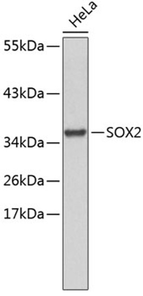 Western blot analysis of extracts of HeLa cells, using SOX2 antibody (CAB6171). Secondary antibody: HRP Goat Anti-Rabbit IgG (H+L) at 1:10000 dilution. Lysates/proteins: 25μg per lane. Blocking buffer: 3% nonfat dry milk in TBST.