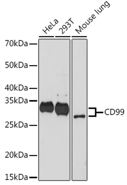 Western blot analysis of extracts of various cell lines, using CD99 antibody (CAB9791) at 1:1000 dilution. Secondary antibody: HRP Goat Anti-Rabbit IgG (H+L) at 1:10000 dilution. Lysates/proteins: 25μg per lane. Blocking buffer: 3% nonfat dry milk in TBST.