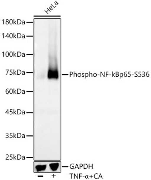 Western blot analysis of extracts of HeLa, using Phospho-NF-kB p65/RelA-S536 antibody (CABP1294) at1:2000 dilution. HeLa cells were treated by100ng/mL TNF-α + 50nM CA at 37℃ for 30 minutes after serum-starvation overnightSecondary antibody: HRP Goat Anti-Rabbit IgG (H+L) at 1:10000 dilution. Lysates/proteins: 25μg per lane. Blocking buffer: 3% nonfat dry milk in TBST.