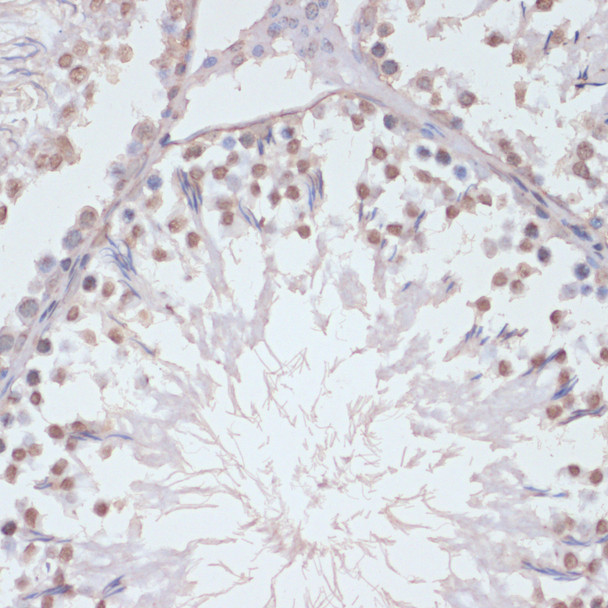 Immunohistochemistry analysis of paraffin-embedded Rat testis using Phospho-p38 MAPK-T180/Y182 antibody (CABP1310) at dilution of 1:200 (40x lens). Perform microwave antigen retrieval with 10 mM Tris/EDTA buffer pH 9. 0 before commencing with IHC staining protocol.