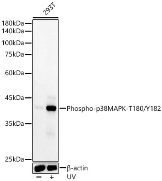 Western blot analysis of various lysates, using Phospho-p38MAPK-T180/Y182 antibody (CABP1311) at 1:20000 dilution. 293T cells were treated by UV at room temperature for 15-30 minutes. Secondary antibody: HRP Goat Anti-Rabbit IgG (H+L) at 1:10000 dilution. Lysates/proteins: 25μg per lane. Blocking buffer: 3% nonfat dry milk in TBST.