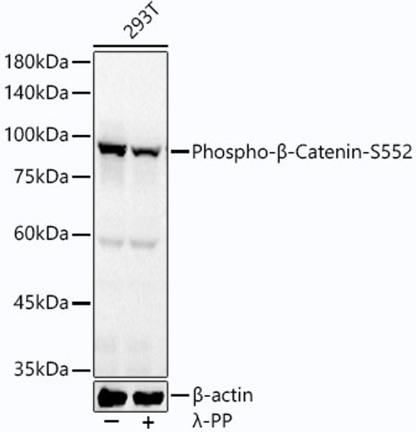 Western blot analysis of extracts from 293T cells, using Phospho-β-Catenin-S552 antibody (CABP1315) at 1000 dilution. 293T cells were treated by λ-PP mixed solution (1ul) at 30℃ for 30 minutes. Secondary antibody: HRP Goat Anti-Rabbit IgG (H+L) at 1:10000 dilution. Lysates/proteins: 25μg per lane. Blocking buffer: 3% nonfat dry milk in TBST.