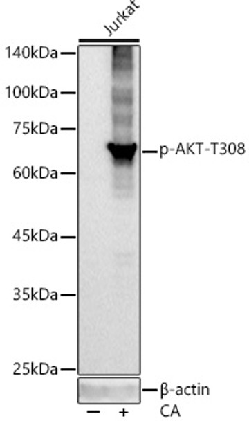 Western blot analysis of extracts of Jurkat, using Phospho-Akt-T308 antibody (CABP1332) at1:2000 dilution. Jurkat cells were treated by Calyculin A (100 nM) at 37℃ for 30 minutes. Secondary antibody: HRP Goat Anti-Rabbit IgG (H+L) at 1:10000 dilution. Lysates/proteins: 25μg per lane. Blocking buffer: 3% nonfat dry milk in TBST.
