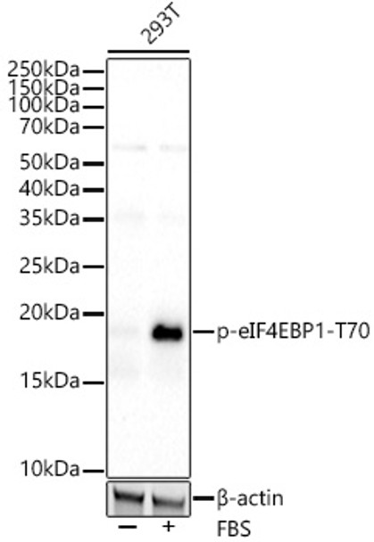 Western blot analysis of extracts of various cell lines, using Phospho-eIF4EBP1-T70 antibody (CABP1334) at 1:5000 dilution. 293T cells were treated by 10% FBS at 37℃ for 30 minutes after serum-starvation overnight. NIH/3T3 cells were treated by CIP(20uL/400ul) at 37℃ for 1 hour. Secondary antibody: HRP Goat Anti-Rabbit IgG (H+L) at 1:10000 dilution. Lysates/proteins: 25μg per lane. Blocking buffer: 3% nonfat dry milk in TBST.