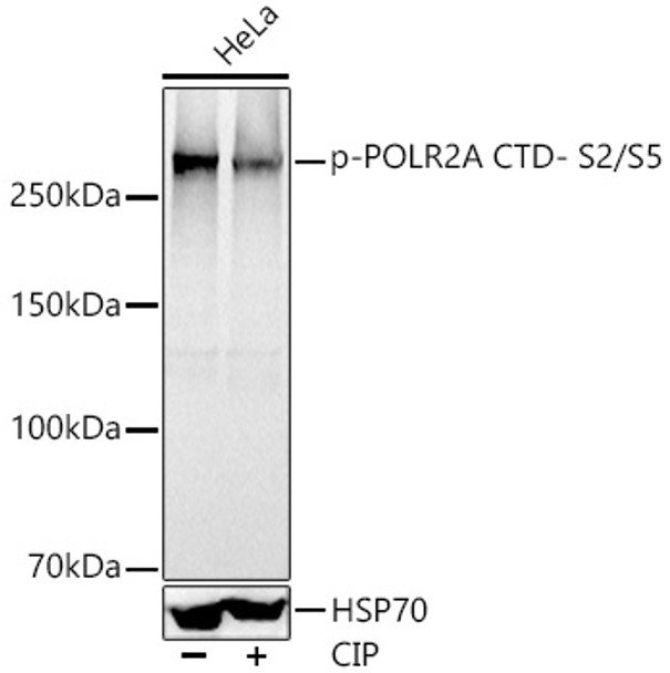 Western blot analysis of HeLa, using Phospho-POLR2A CTD- S2/S5 antibody (CABP1335) at 1:1000 dilution. Hela cells were treated by CIP(20uL/400ul) at 37℃ for 1 hour. Secondary antibody: HRP Goat Anti-Rabbit IgG (H+L) at 1:10000 dilution. Lysates/proteins: 25μg per lane. Blocking buffer: 3% nonfat dry milk in TBST.