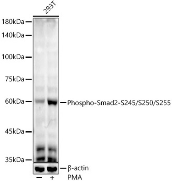 Western blot analysis of various lysates, using Phospho-Smad2-S245/S250/S255 antibody (CABP1338) at1:2000 dilution. 293T cells were treated by PMA/TPA (200 nM) at 37℃ for 30 minutes after serum-starvation overnight. Secondary antibody: HRP Goat Anti-Rabbit IgG (H+L) at 1:10000 dilution. Lysates/proteins: 25μg per lane. Blocking buffer: 3% nonfat dry milk in TBST.
