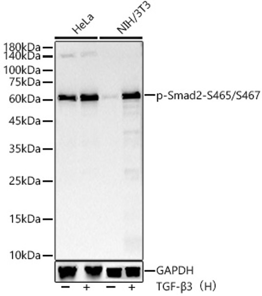 Western blot analysis of extracts of various lysates, using Phospho-Smad2-S465/S467 antibody (CABP1342) at1:2000 dilution. HeLa and NIH/3T3 were treated by TGF-β3（H） (200 ng/mL) at 37℃ for 30 minutes after serum-starvation overnight. Secondary antibody: HRP Goat Anti-Rabbit IgG (H+L) at 1:10000 dilution. Lysates/proteins: 25μg per lane. Blocking buffer: 3% nonfat dry milk in TBST.