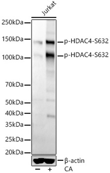 Western blot analysis of extracts of Jurkat cells, using Phospho-HDAC4-S632 antibody (CABP1344) at1:2000 dilution. Jurkat cells were treated by Calyculin A (100 nM) at 37℃ for 30 minutes. Secondary antibody: HRP Goat Anti-Rabbit IgG (H+L) at 1:10000 dilution. Lysates/proteins: 25μg per lane. Blocking buffer: 3% nonfat dry milk in TBST.