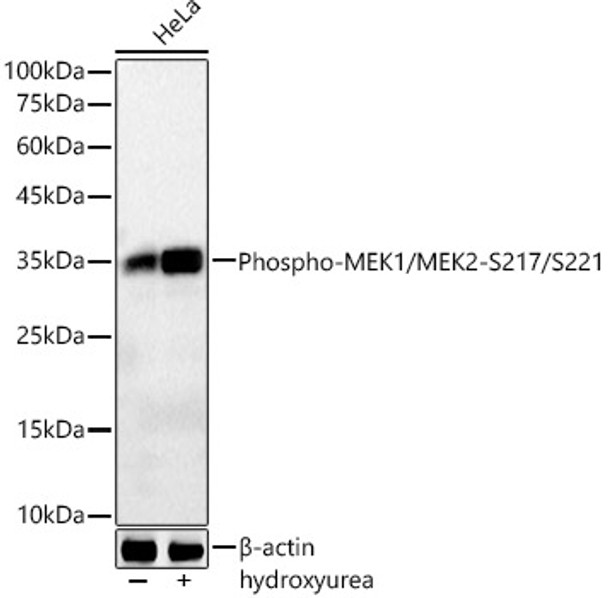 Western blot analysis of various lysates, using Phospho-CDK1-Y15 antibody (CABP1350) at1:2000 dilution. HeLa cells were treated by Hydroxyurea (4 mM) at 37℃ for 20 hours. Secondary antibody: HRP Goat Anti-Rabbit IgG (H+L) at 1:10000 dilution. Lysates/proteins: 25μg per lane. Blocking buffer: 3% nonfat dry milk in TBST.