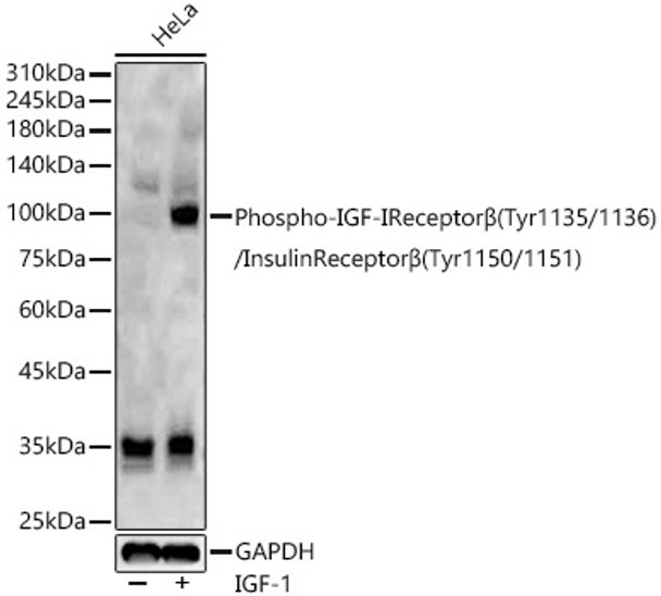 Western blot analysis of HeLa, using Phospho-IGF-IReceptorβ(Tyr1135/1136)/InsulinReceptorβ(Tyr1150/1151) antibody (CABP1352) at 1:2000 dilution. HeLa cells were treated by IGF-1 (50 ng/ml) at 37℃ for 30 minutes after serum-starvation overnight. Secondary antibody: HRP Goat Anti-Rabbit IgG (H+L) at 1:10000 dilution. Lysates/proteins: 25μg per lane. Blocking buffer: 3% nonfat dry milk in TBST.
