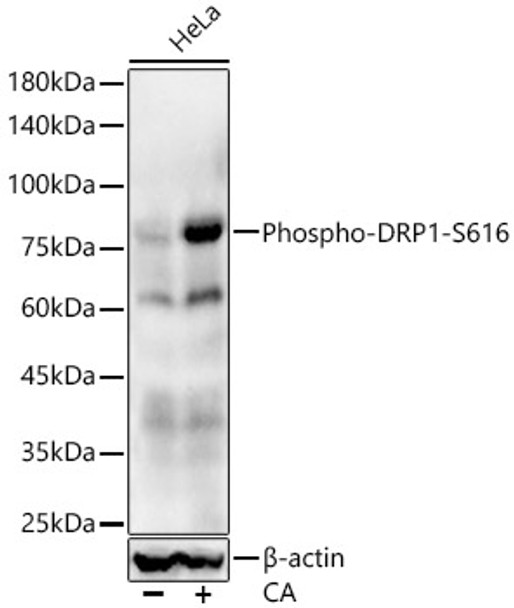 Western blot analysis of various lysates, using Phospho-DRP1-S616 antibody (CABP1353) at 1:10000 dilution. HeLa cells were treated by Calyculin A (100 nM) at 37℃ for 30 minutes after serum-starvation overnight. Secondary antibody: HRP Goat Anti-Rabbit IgG (H+L) at 1:100000 dilution. Lysates/proteins: 25μg per lane. Blocking buffer: 3% nonfat dry milk in TBST.