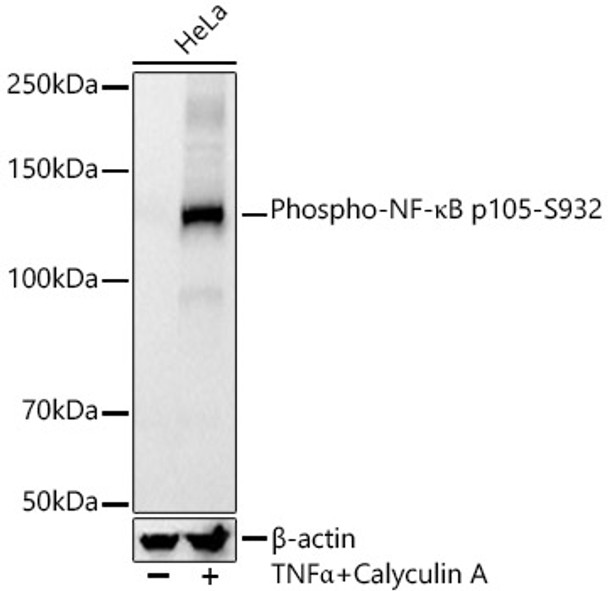 Western blot analysis of various lysates, using Phospho-NF-κB p105-S932 antibody (CABP1355) at1:2000 dilution. HeLa cells were treated by TNF-α (20 ng/ml) and Calyculin A (100 nM) at 37℃ for 10 minutes. Secondary antibody: HRP Goat Anti-Rabbit IgG (H+L) at 1:10000 dilution. Lysates/proteins: 25μg per lane. Blocking buffer: 3% nonfat dry milk in TBST.