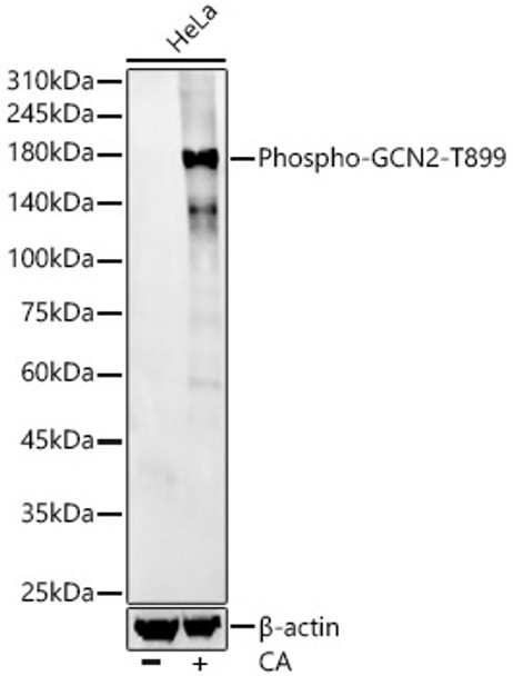 Western blot analysis of various lysates, using Phospho-GCN2-T899 antibody (CABP1356) at1:2000 dilution. HeLa cells were treated by Calyculin A (100 nM) at 37℃ for 30 minutes after serum-starvation overnight. Secondary antibody: HRP Goat Anti-Rabbit IgG (H+L) at 1:10000 dilution. Lysates/proteins: 25μg per lane. Blocking buffer: 3% nonfat dry milk in TBST.