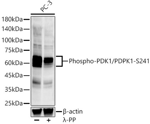 Western blot analysis of various lysates, using Phospho-PDK1/PDPK1-S241 antibody (CABP1357) at1:2000 dilution. PC-3 cells were treated by λ-PP mixed solution (1ul) at 30℃ for 30 minutes. Secondary antibody: HRP Goat Anti-Rabbit IgG (H+L) at 1:10000 dilution. Lysates/proteins: 25μg per lane. Blocking buffer: 3% nonfat dry milk in TBST.