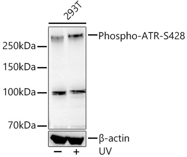 Western blot analysis of various lysates, using Phospho-ATR-S428 antibody (CABP1358) at1:2000 dilution. 293T cells were treated by UV at room temperature for 15-30 minutes. Secondary antibody: HRP Goat Anti-Rabbit IgG (H+L) at 1:10000 dilution. Lysates/proteins: 25μg per lane. Blocking buffer: 3% nonfat dry milk in TBST.