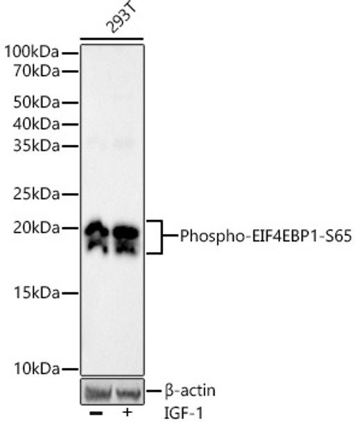 Western blot analysis of 293T, using Phospho-EIF4EBP1-S65 antibody (CABP1363) at 1:20000 dilution. 293T cells were treated by IGF-1 (50 ng/ml) at 37℃ for 5 minutes after serum-starvation overnight. Secondary antibody: HRP Goat Anti-Rabbit IgG (H+L) at 1:10000 dilution. Lysates/proteins: 25μg per lane. Blocking buffer: 3% nonfat dry milk in TBST.