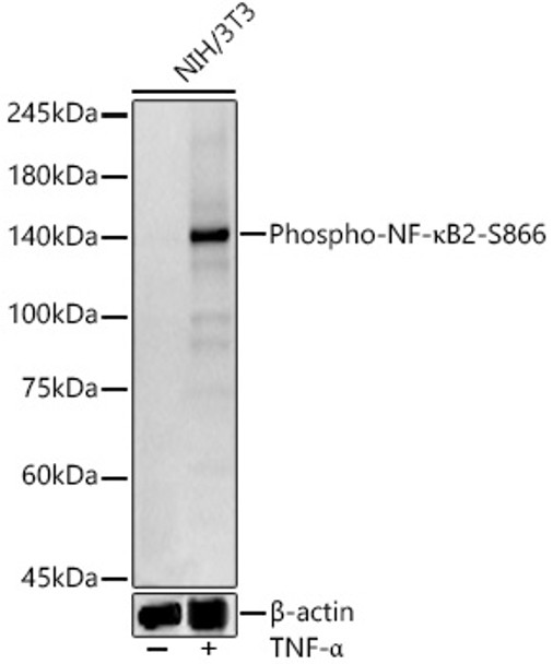 Western blot analysis of NIH/3T3, using Phospho-NF-κB2-S866 antibody (CABP1367) at 1:500 dilution. NIH/3T3 cells were treated by TNF-α (20 ng/ml) at 37℃ for 30 minutes. Secondary antibody: HRP Goat Anti-Rabbit IgG (H+L) at 1:10000 dilution. Lysates/proteins: 25μg per lane. Blocking buffer: 3% nonfat dry milk in TBST.