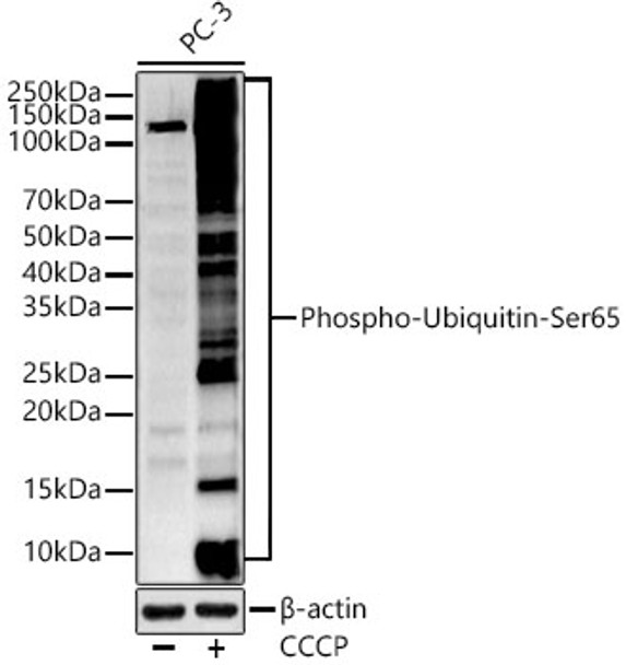 Western blot analysis of PC-3, using Phospho-Ubiquitin-Ser65 antibody (CABP1368) at 1:400 dilution. PC-3 cells were treated by Carbonyl cyanide 3-chlorophenylhydrazone(10 uM) (10 µM) at 37℃ for 6 hours after serum-starvation overnight. Secondary antibody: HRP Goat Anti-Rabbit IgG (H+L) at 1:10000 dilution. Lysates/proteins: 25μg per lane. Blocking buffer: 3% nonfat dry milk in TBST.