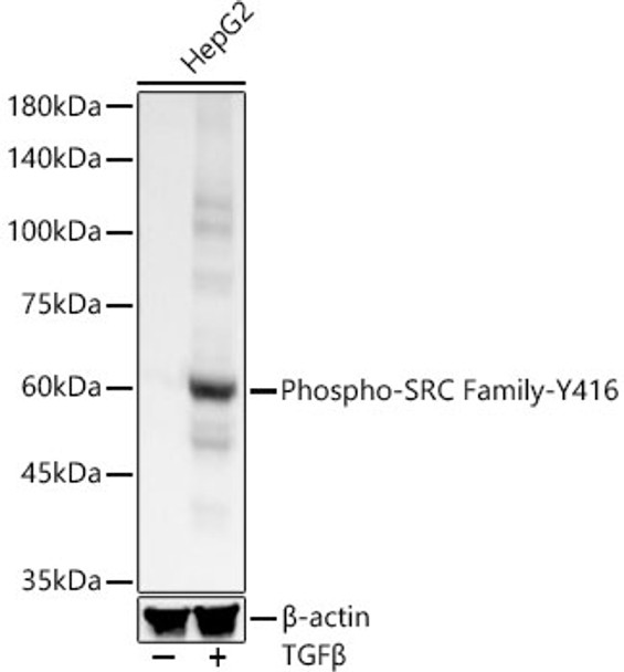 Western blot analysis of HepG2, using Phospho-SRC Family-Y416 antibody (CABP1370) at 1:300 dilution. HepG2 cells were treated by TGF-β (10 ng/ml) at 37℃ for 30 minutes after serum-starvation overnight. Secondary antibody: HRP Goat Anti-Rabbit IgG (H+L) at 1:10000 dilution. Lysates/proteins: 25μg per lane. Blocking buffer: 3% nonfat dry milk in TBST.