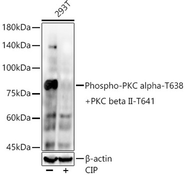 Western blot analysis of extracts from 293T cells, using Phospho-PKC alpha-T638 + PKC beta II-T641 Rabbit mAb (CABP1375) at 1:6000 dilution. 293T cells were treated by CIP(20μL/400μL) at 37℃ for 1 hour. Secondary antibody: HRP Goat Anti-Rabbit IgG (H+L) at 1:10000 dilution. Lysates/proteins: 25μg per lane. Blocking buffer: 3% nonfat dry milk in TBST.