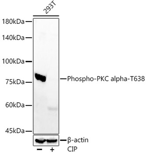 Western blot analysis of 293T cells, using Phospho-PKC alpha-T638 antibody (CABP1376) at 1:7000 dilution. 293T cells were treated by CIP(20uL/400ul) at 37℃ for 1 hour. Secondary antibody: HRP Goat Anti-Rabbit IgG (H+L) at 1:10000 dilution. Lysates/proteins: 25μg per lane. Blocking buffer: 3% nonfat dry milk in TBST.