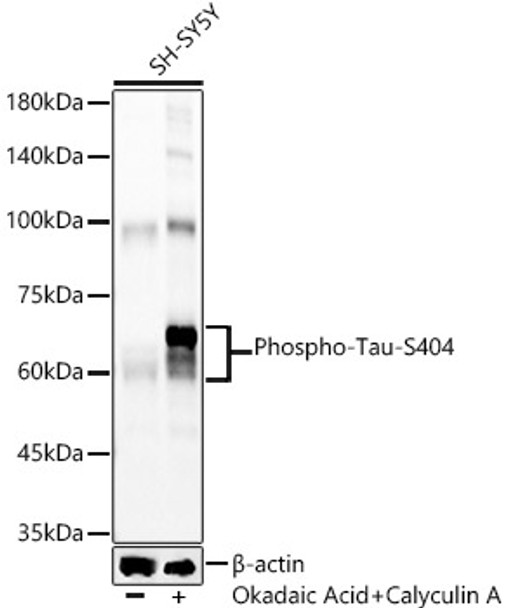 Western blot analysis of extracts from SH-SY5Y cells, using Phospho-Tau-S404 antibody (CABP1378) at 1:5000 dilution. SH-SY5Y cells were treated by Okadaic Acid (100 nM) at 37℃ for 1 hour and Calyculin A (100nM) at 37℃ for 30 minutes after serum-starvation overnight. Secondary antibody: HRP Goat Anti-Rabbit IgG (H+L) at 1:10000 dilution. Lysates/proteins: 25μg per lane. Blocking buffer: 3% nonfat dry milk in TBST.