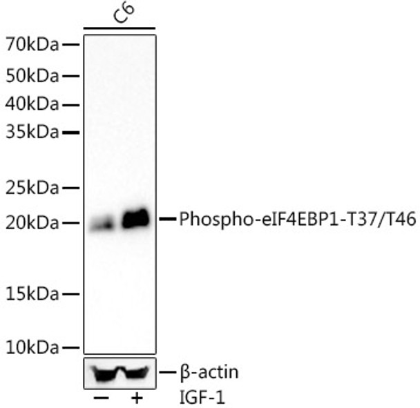 Western blot analysis of extracts from C6 cells, using Phospho-eIF4EBP1-T37/T46 Rabbit mAb (CABP1381) at 1:7000 dilution. C6 cells were treated by IGF-1 (100 ng/ml) at 37℃ for 30 minutes after serum-starvation overnight. Secondary antibody: HRP Goat Anti-Rabbit IgG (H+L) at 1:10000 dilution. Lysates/proteins: 25ug per lane. Blocking buffer: 3% nonfat dry milk in TBST.