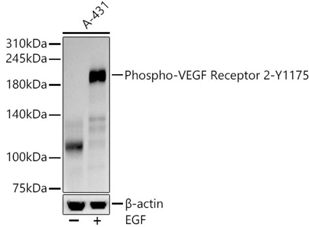 Western blot analysis of A-431 lysates, using Phospho-VEGF Receptor 2-Y1175 antibody (CABP1385) at 1:3000 dilution. A-431 cells were treated by EGF (100 ng/ml) at 37℃ for 30 minutes after serum-starvation overnight. Secondary antibody: HRP Goat Anti-Rabbit IgG (H+L) at 1:10000 dilution. Lysates/proteins: 25μg per lane. Blocking buffer: 3% nonfat dry milk in TBST.