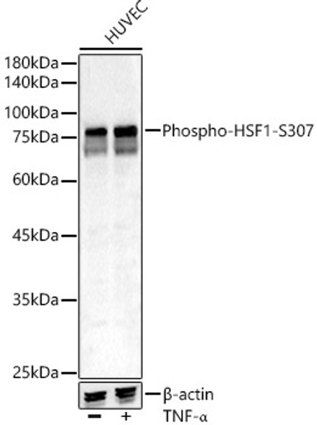 Western blot analysis of various lysates, using Phospho-HSF1-S307 antibody (CABP1396) at 1:500 dilution. Secondary antibody: HRP Goat Anti-Rabbit IgG (H+L) at 1:10000 dilution. Lysates/proteins: 25μg per lane. Blocking buffer: 3% nonfat dry milk in TBST.