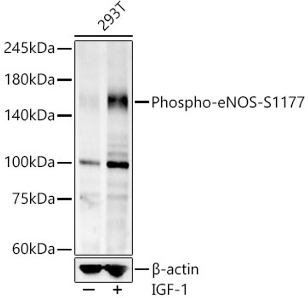 Western blot analysis of 293T lysates, using Phospho-eNOS-S1177 antibody (CABP1404) at 1:7000 dilution. 293T cells were treated by IGF-1 (50 ng/ml) at 37℃ for 5 minutes after serum-starvation overnight. Secondary antibody: HRP Goat Anti-Rabbit IgG (H+L) at 1:10000 dilution. Lysates/proteins: 25μg per lane. Blocking buffer: 3% nonfat dry milk in TBST.