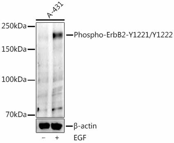Western blot analysis of A-431, using Phospho-ErbB2(Y1221 + Y1222) Rabbit mAb (CABP1424) at 1:1000 dilution. A-431 cells were treated by EGF (200 ng/ml) at 37℃ for 30 minutes. Secondary antibody: HRP Goat Anti-Rabbit IgG (H+L) at 1:10000 dilution. Lysates/proteins: 25μg per lane. Blocking buffer: 3% nonfat dry milk in TBST.