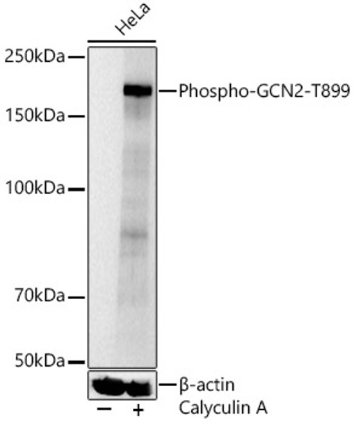 Western blot analysis of HeLa, using Phospho-GCN2-T899 Rabbit pAb (CABP1428) at 1:1000 dilution. HeLa cells were treated by Calyculin A (100 nM) at 37℃ for 30 minutes. Secondary antibody: HRP Goat Anti-Rabbit IgG (H+L) at 1:10000 dilution. Lysates/proteins: 25μg per lane. Blocking buffer: 3% nonfat dry milk in TBST.