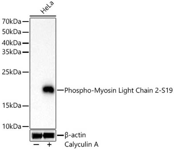 Western blot analysis of HeLa, using Phospho-Myosin Light Chain 2-S19 Rabbit mAb (CABP1433) at 1:1000 dilution. HeLa cells were treated by Calyculin A (100 nM) at 37℃ for 30 minutes after serum-starvation overnight. Secondary antibody: HRP Goat Anti-Rabbit IgG (H+L) at 1:10000 dilution. Lysates/proteins: 25μg per lane. Blocking buffer: 3% nonfat dry milk in TBST.