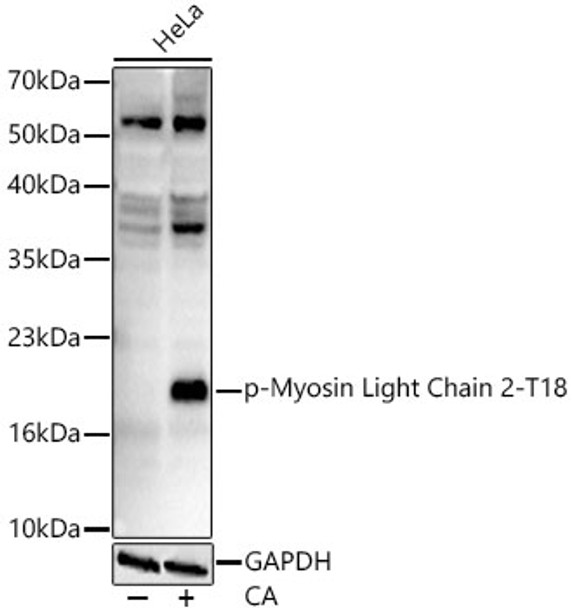 Western blot analysis of HeLa, using Phospho-Myosin Light Chain 2-T18 Rabbit mAb (CABP1439) at 1:1000 dilution. HeLa cells were treated by Calyculin A (100 nM) at 37℃ for 30 minutes after serum-starvation overnight. Secondary antibody: HRP Goat Anti-Rabbit IgG (H+L) at 1:10000 dilution. Lysates/proteins: 25μg per lane. Blocking buffer: 3% nonfat dry milk in TBST.