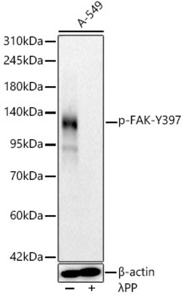 Western blot analysis of A-549, using Phospho-FAK-Y397 Rabbit mAb (CABP1447) at 1:4000 dilution. A-549 cells were treated by λ-PP mixed solution (1ul) at 30℃ for 30 minutes. Secondary antibody: HRP Goat Anti-Rabbit IgG (H+L) at 1:10000 dilution. Lysates/proteins: 25ug per lane. Blocking buffer: 3% nonfat dry milk in TBST.