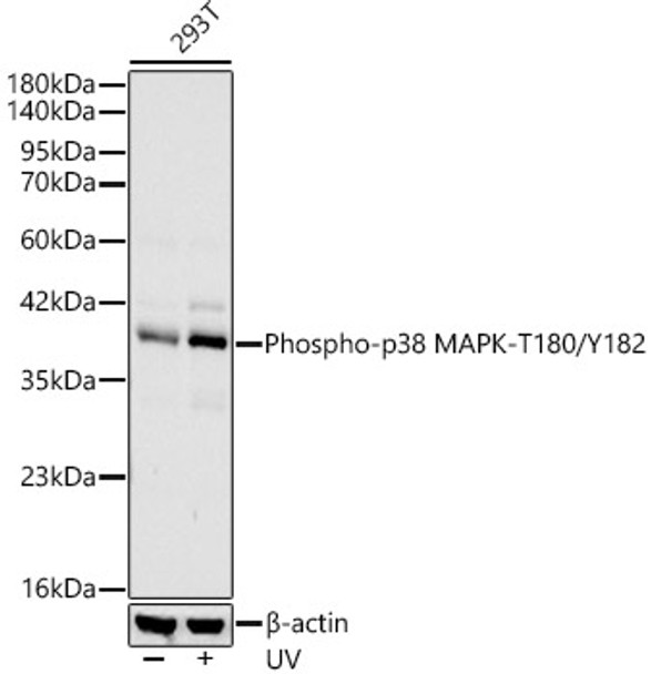 Western blot analysis of 293T, using Phospho-p38 MAPK-T180/Y182 Rabbit mAb (CABP1502) at 1:1000 dilution. 293T cells were treated by UV at room temperature for 15-30 minutes. Secondary antibody: HRP Goat Anti-Rabbit IgG (H+L) at 1:10000 dilution. Lysates/proteins: 25ug per lane. Blocking buffer: 3% nonfat dry milk in TBST.