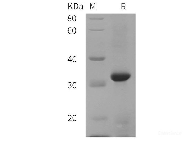Cynomolgus macaques CD38/ADPRC1 Recombinant Protein (His tag)