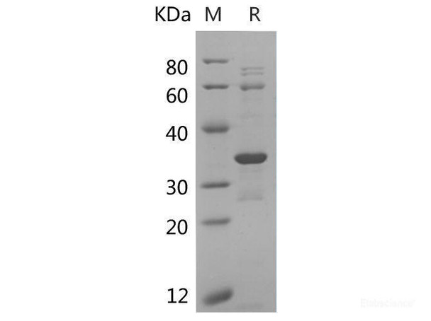 Human CDK2 Recombinant Protein (E.coli, His Tag)