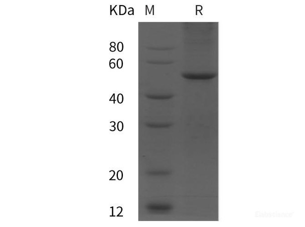 Human KIM-1 Recombinant Protein (GST tag)