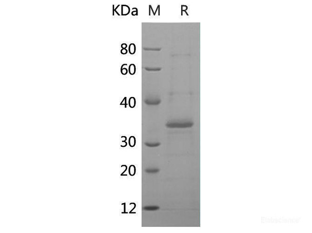 Human HO1 Recombinant Protein (His tag)