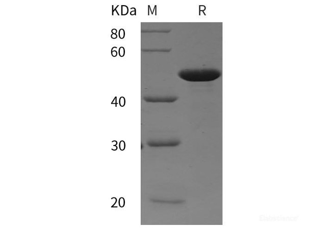 Human FGFR3 Recombinant Protein (His tag)