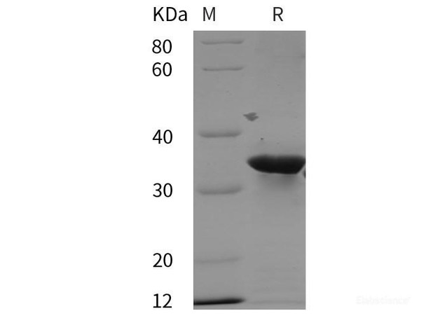 Human PRRG2 Recombinant Protein (GST,His tag)