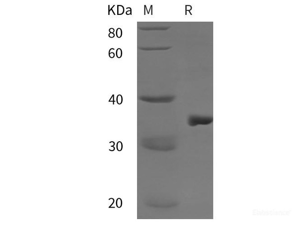 Human DRP1 Recombinant Protein (His tag)