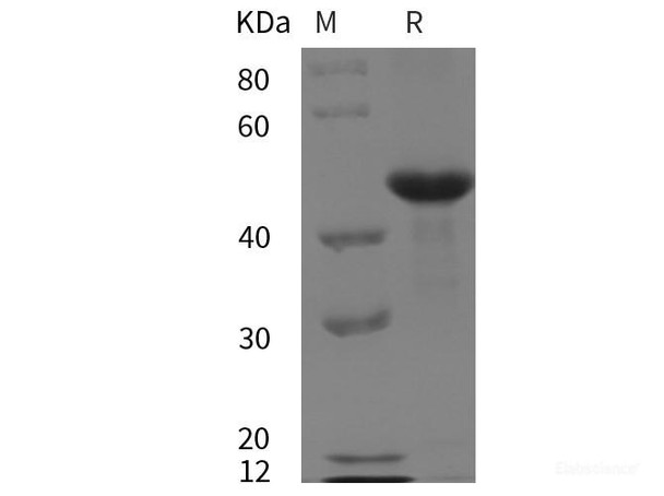 Mouse MMP-9 Recombinant Protein (His tag)