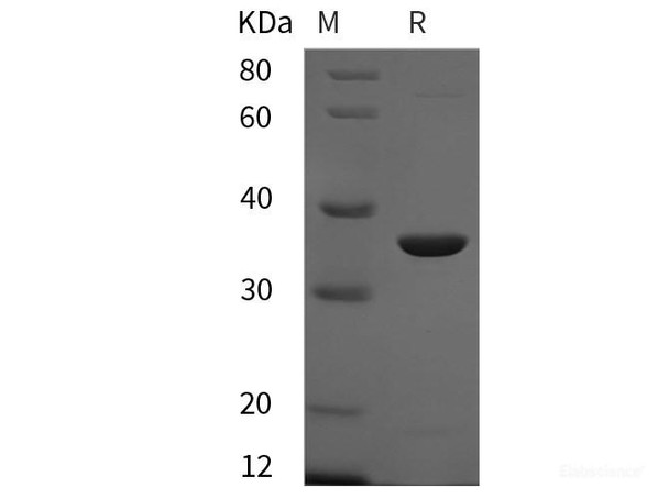 Mouse Annexin V Recombinant Protein (His tag)