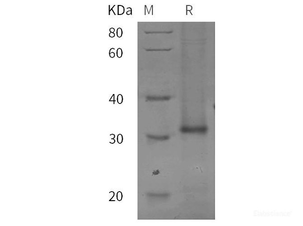 Mouse IL7R/IL-7R/CD127 Recombinant Protein (His tag)